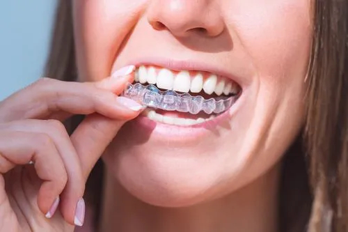 Discreet Clear Aligner Treatment in Carrollton TX