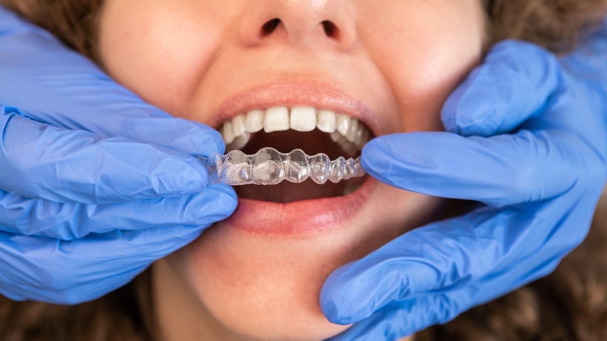 Featured image for “Is Invisalign Right for Your Teeth, or Do You Need Braces”