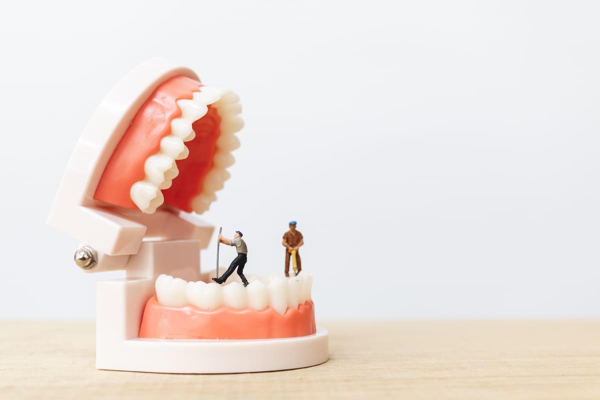 Featured image for “Will Your Gum Treatment Results Last Five Years or Fifteen”